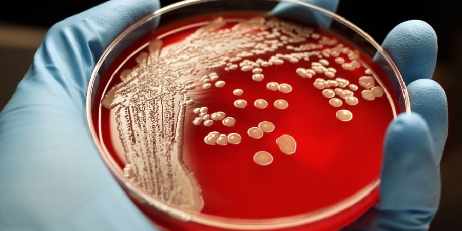 Pictured: A petri dish containing  Methicillin-resistant Staphylococcus aureus (MRSA)