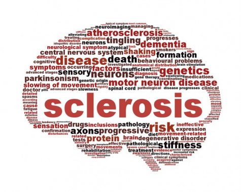 Cannabis for Multiple Sclerosis: How can it help to relieve the symptoms of MS?