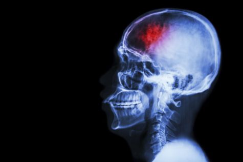 https://blog.bulletproof.com/bouncing-back-after-traumatic-brain-injury/