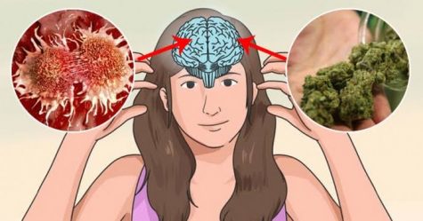 Researchers are investigating cannabis’ potential for treating brain tumors