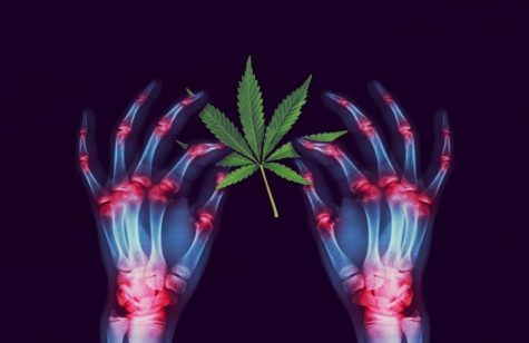 Cannabis as an anti-inflammatory: Here’s what researchers have discovered